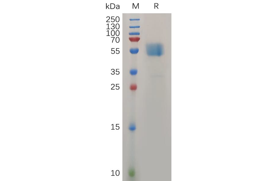 SDS-PAGE - Recombinant Human TMIGD2/IGPR1 Protein (Fc Tag) (A317277) - Antibodies.com