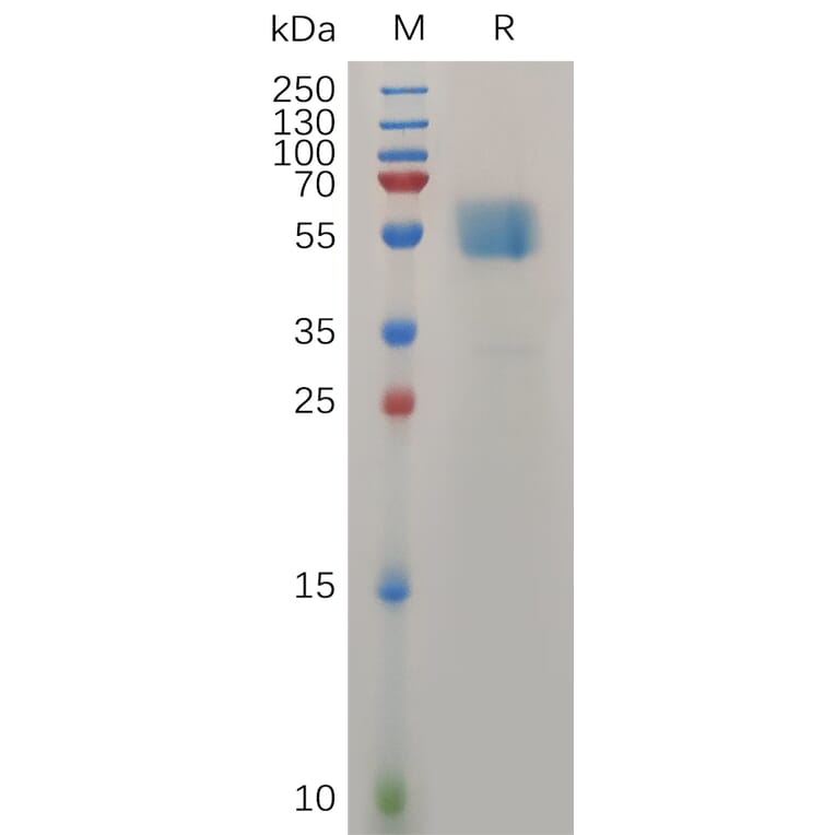 SDS-PAGE - Recombinant Human TMIGD2/IGPR1 Protein (Fc Tag) (A317277) - Antibodies.com