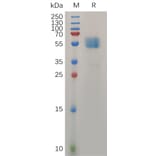 SDS-PAGE - Recombinant Human TMIGD2/IGPR1 Protein (Fc Tag) (A317277) - Antibodies.com