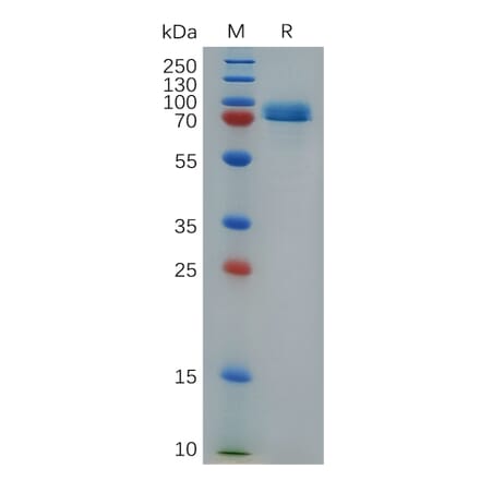 SDS-PAGE - Recombinant Human STAB1 Protein (Fc Tag) (A317278) - Antibodies.com