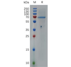 SDS-PAGE - Recombinant Human Heparanase 1 Protein (6×His Tag) (A317279) - Antibodies.com