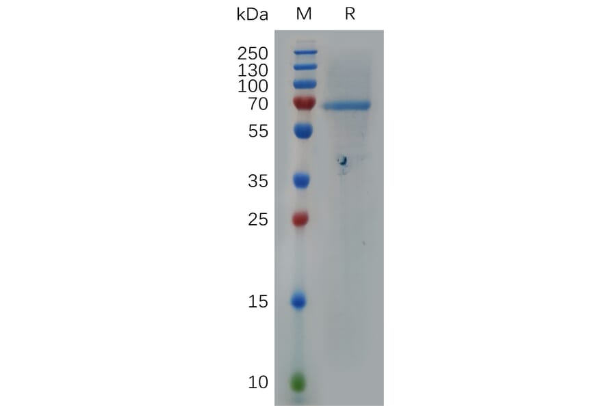 SDS-PAGE - Recombinant Human Heparanase 1 Protein (6×His Tag) (A317279) - Antibodies.com