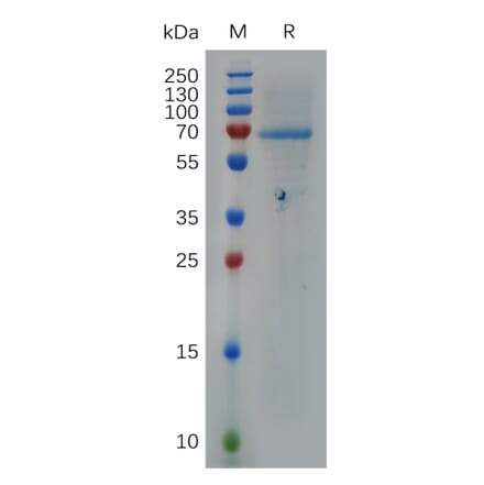 SDS-PAGE - Recombinant Human Heparanase 1 Protein (6×His Tag) (A317279) - Antibodies.com