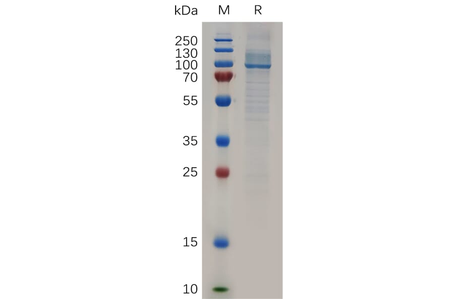 SDS-PAGE - Recombinant Human HSP90 alpha Protein (6×His Tag) (A317280) - Antibodies.com