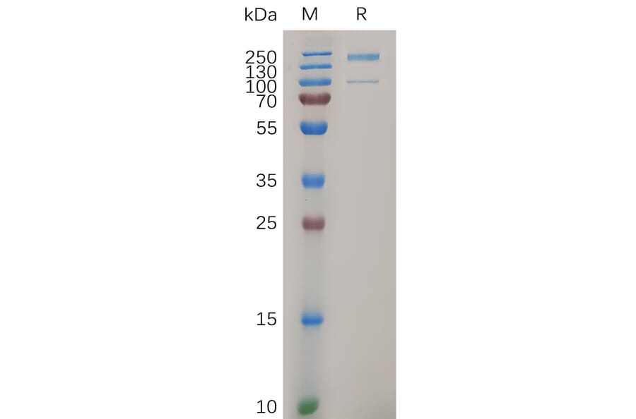 SDS-PAGE - Recombinant Human Integrin alpha 2 Protein (6×His Tag) (A317281) - Antibodies.com