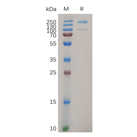 SDS-PAGE - Recombinant Human Integrin alpha 2 Protein (6×His Tag) (A317281) - Antibodies.com