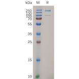 SDS-PAGE - Recombinant Human Integrin alpha 2 Protein (6×His Tag) (A317281) - Antibodies.com