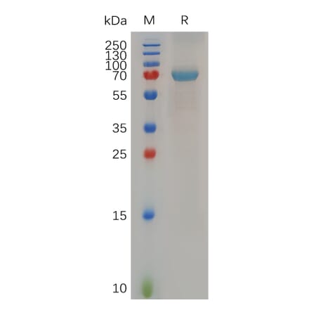 SDS-PAGE - Recombinant Human B4GALT1 Protein (Fc Tag) (A317282) - Antibodies.com