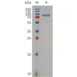SDS-PAGE - Recombinant Human MMP13 Protein (Fc Tag) (A317283) - Antibodies.com