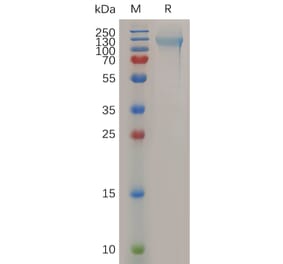 SDS-PAGE - Recombinant Human Nucleolin Protein (6×His Tag) (A317284) - Antibodies.com