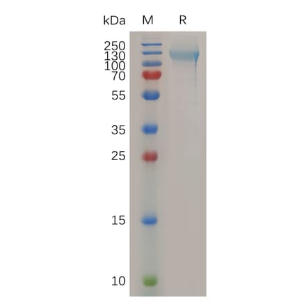 SDS-PAGE - Recombinant Human Nucleolin Protein (6×His Tag) (A317284) - Antibodies.com