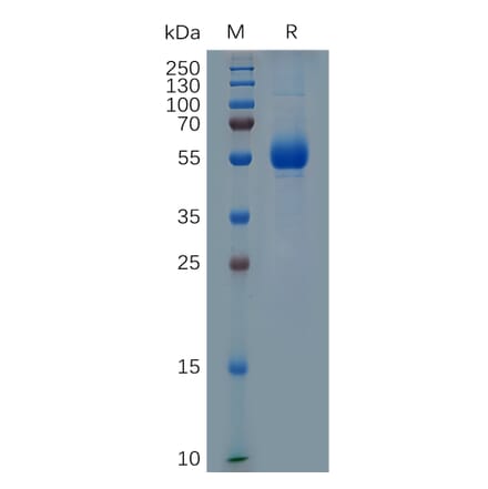 SDS-PAGE - Recombinant Human CD33 Protein (Fc Tag) (A317286) - Antibodies.com