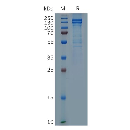 SDS-PAGE - Recombinant Human E Cadherin Protein (Fc Tag) (A317287) - Antibodies.com