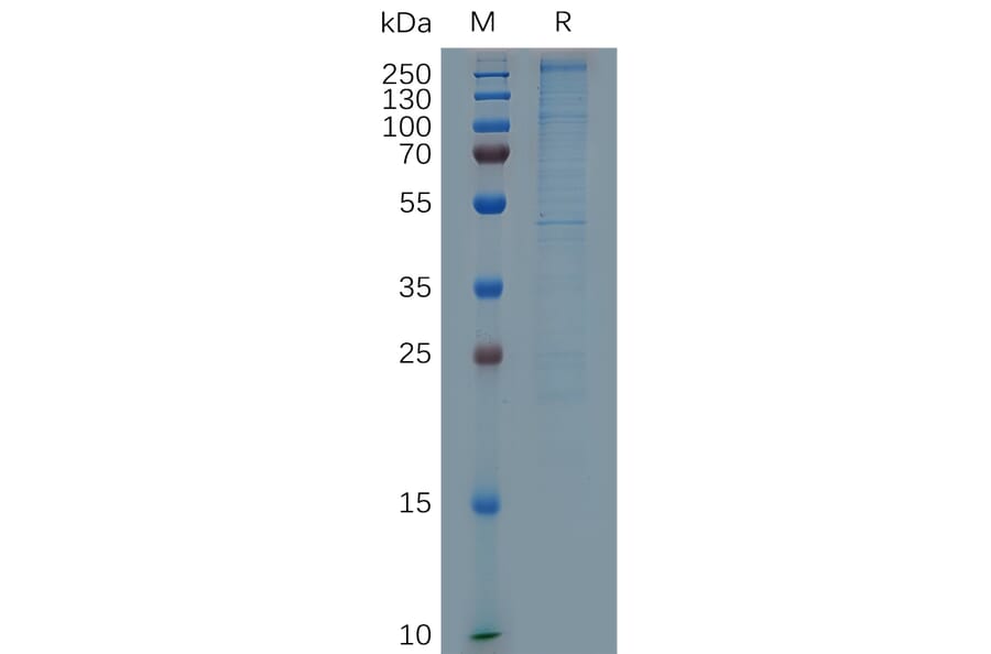 SDS-PAGE - Recombinant Human Laminin alpha 4/LAMA4 Protein (6×His Tag) (A317288) - Antibodies.com