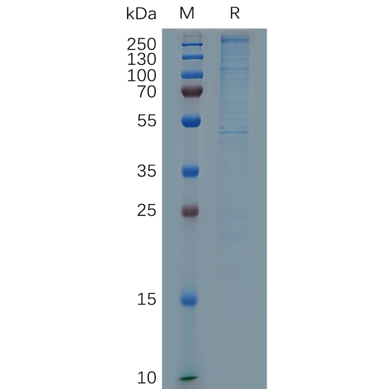 SDS-PAGE - Recombinant Human Laminin alpha 4/LAMA4 Protein (6×His Tag) (A317288) - Antibodies.com