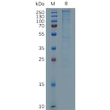 SDS-PAGE - Recombinant Human Laminin alpha 4/LAMA4 Protein (6×His Tag) (A317288) - Antibodies.com