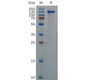 SDS-PAGE - Recombinant Human CD93 Protein (Fc Tag) (A317289) - Antibodies.com