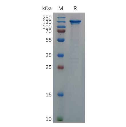 SDS-PAGE - Recombinant Human CD93 Protein (Fc Tag) (A317289) - Antibodies.com