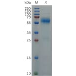 SDS-PAGE - Recombinant SARS-CoV-2 Nucleocapsid Protein (Omicron B.1.1.529) (6×His Tag) (A317290) - Antibodies.com
