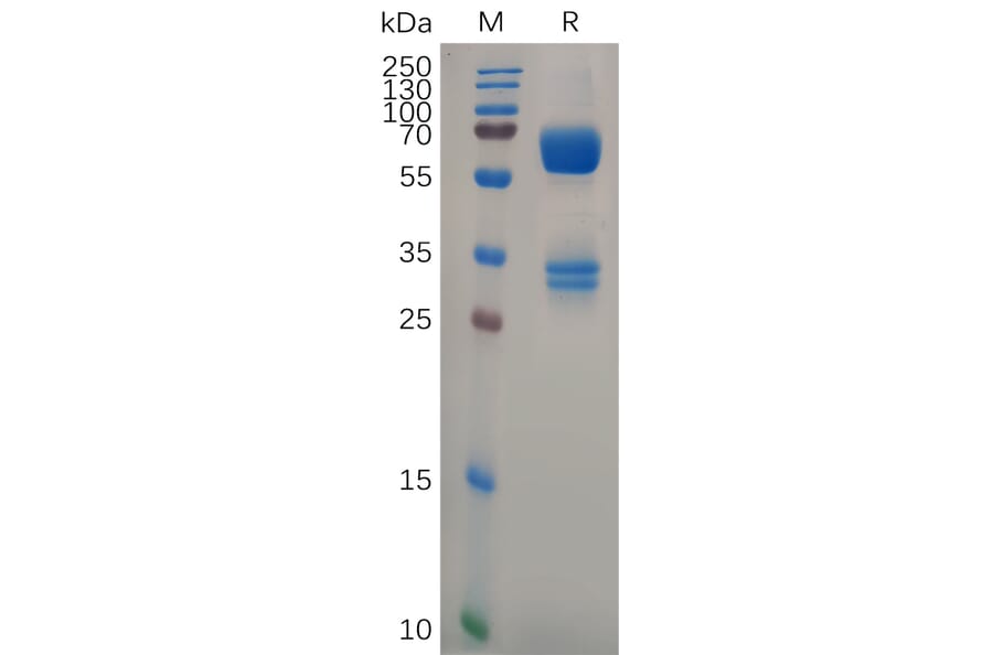 SDS-PAGE - Recombinant Human CD74 Protein (Fc Tag) (A317293) - Antibodies.com