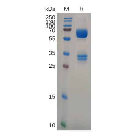 SDS-PAGE - Recombinant Human CD74 Protein (Fc Tag) (A317293) - Antibodies.com