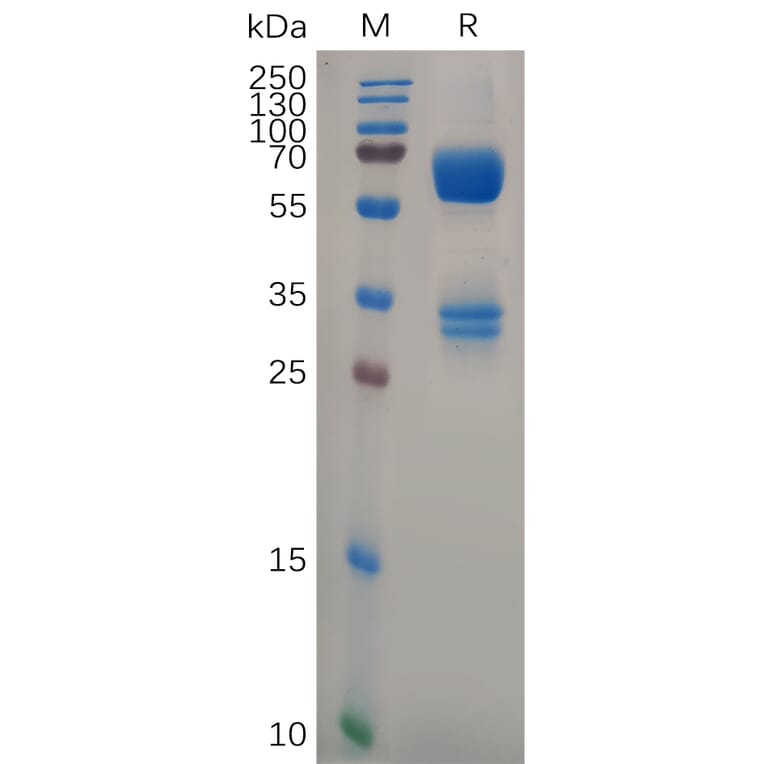 SDS-PAGE - Recombinant Human CD74 Protein (Fc Tag) (A317293) - Antibodies.com