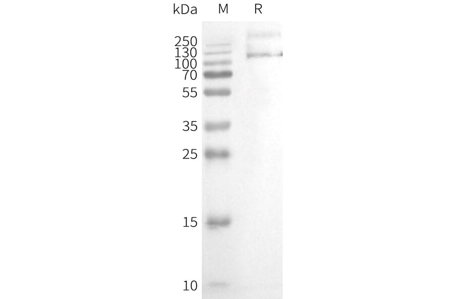 Western Blot - Synthetic Nanodisc Human TRPV1 Protein (A317302) - Antibodies.com