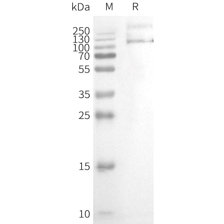 Western Blot - Synthetic Nanodisc Human TRPV1 Protein (A317302) - Antibodies.com