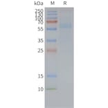 SDS-PAGE - Synthetic Nanodisc Human Frizzled 7 Protein (A317320) - Antibodies.com