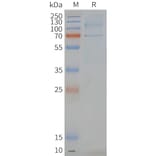SDS-PAGE - Synthetic Nanodisc Human GPCR LGR6 Protein (A317343) - Antibodies.com