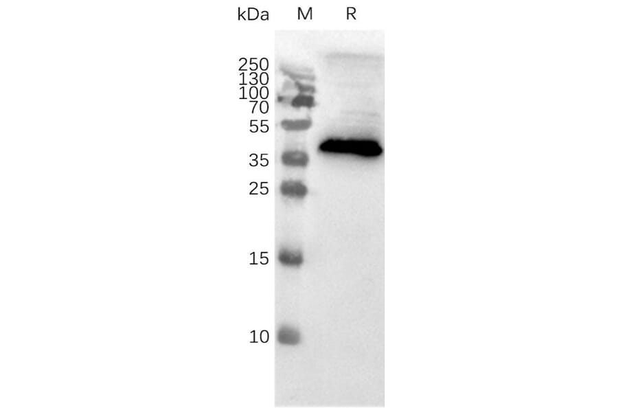 Western Blot - Synthetic Membrane Nanoparticle Human CCR8 Protein (A317352) - Antibodies.com