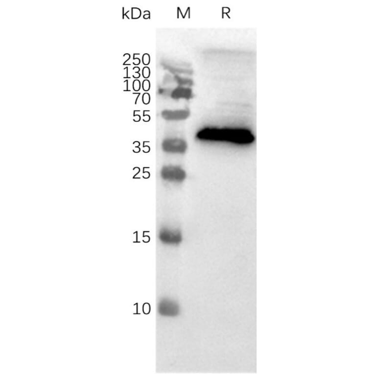 Western Blot - Synthetic Membrane Nanoparticle Human CCR8 Protein (A317352) - Antibodies.com