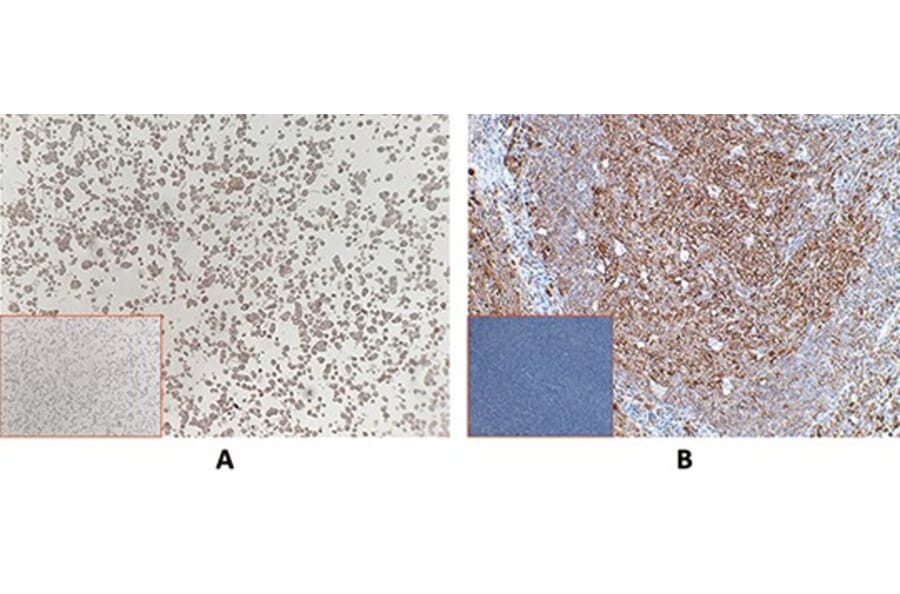Immunohistochemistry - Anti-Mesothelin Antibody [DM71] - BSA and Azide free (A317392) - Antibodies.com