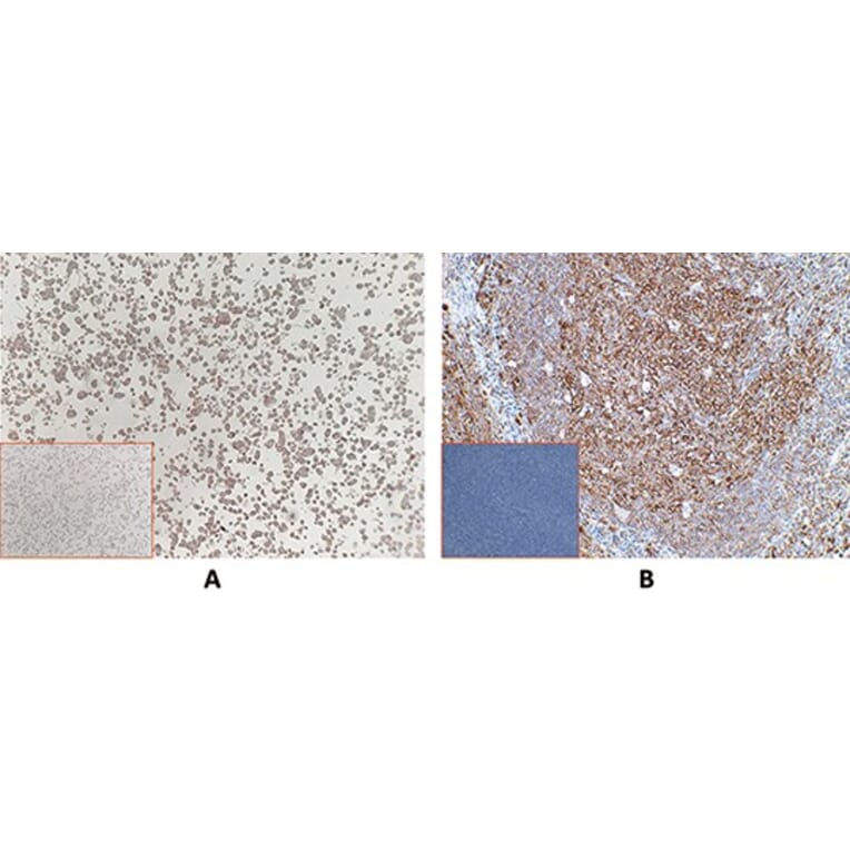 Immunohistochemistry - Anti-Mesothelin Antibody [DM71] - BSA and Azide free (A317392) - Antibodies.com