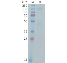 SDS-PAGE - Recombinant Mouse IGF1 Receptor Protein (6×His Tag) (A317441) - Antibodies.com