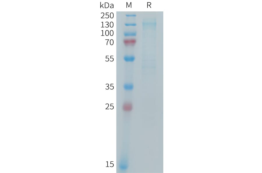 SDS-PAGE - Recombinant Mouse IGF1 Receptor Protein (6×His Tag) (A317441) - Antibodies.com