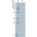 SDS-PAGE - Recombinant Mouse IGF1 Receptor Protein (6×His Tag) (A317441) - Antibodies.com