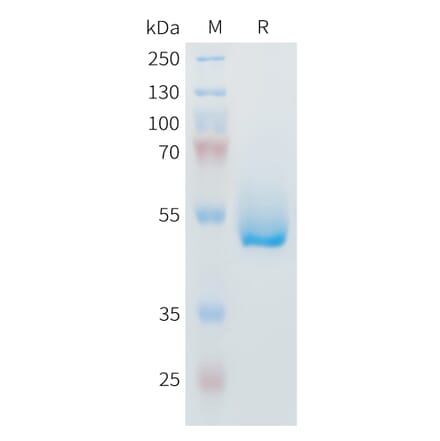 SDS-PAGE - Recombinant Mouse IL-6 Protein (Fc Tag) (A317442) - Antibodies.com