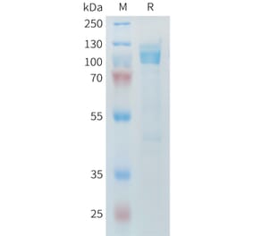 SDS-PAGE - Recombinant Mouse LI Cadherin Protein (6×His Tag) (A317444) - Antibodies.com