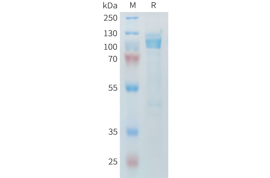 SDS-PAGE - Recombinant Mouse LI Cadherin Protein (6×His Tag) (A317444) - Antibodies.com