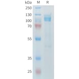 SDS-PAGE - Recombinant Mouse LI Cadherin Protein (6×His Tag) (A317444) - Antibodies.com