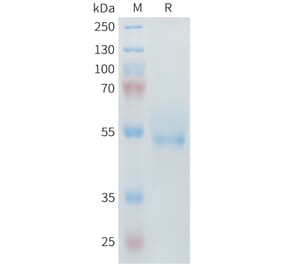 SDS-PAGE - Recombinant Mouse ROR2 Protein (6×His Tag) (A317445) - Antibodies.com
