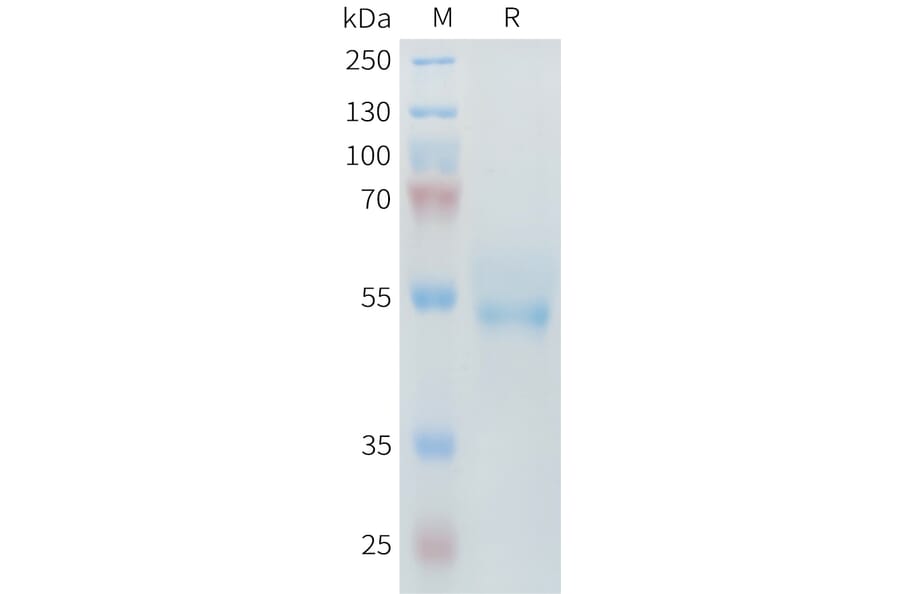 SDS-PAGE - Recombinant Mouse ROR2 Protein (6×His Tag) (A317445) - Antibodies.com
