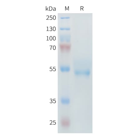 SDS-PAGE - Recombinant Mouse ROR2 Protein (6×His Tag) (A317445) - Antibodies.com