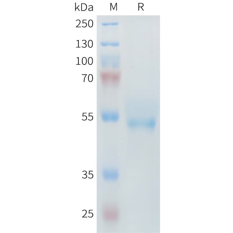 SDS-PAGE - Recombinant Mouse ROR2 Protein (6×His Tag) (A317445) - Antibodies.com