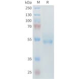 SDS-PAGE - Recombinant Mouse ROR2 Protein (6×His Tag) (A317445) - Antibodies.com