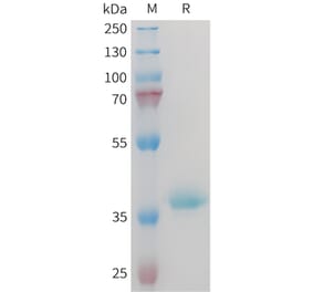 SDS-PAGE - Recombinant Mouse IGF1 Protein (Fc Tag) (A317446) - Antibodies.com