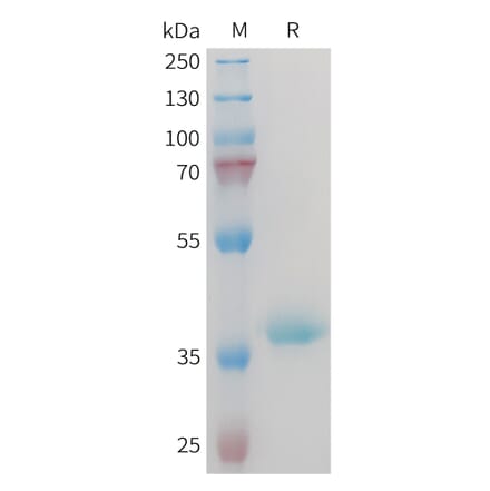 SDS-PAGE - Recombinant Mouse IGF1 Protein (Fc Tag) (A317446) - Antibodies.com