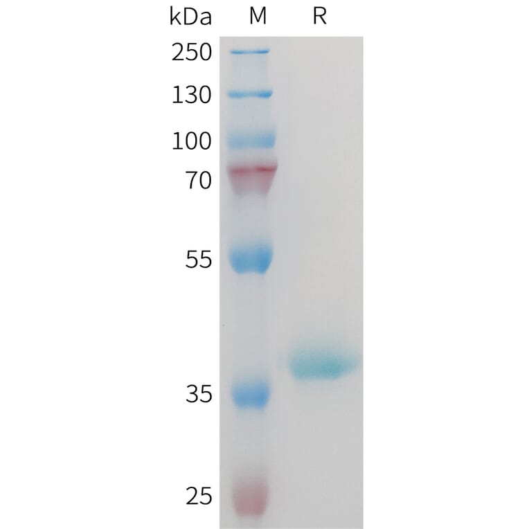 SDS-PAGE - Recombinant Mouse IGF1 Protein (Fc Tag) (A317446) - Antibodies.com