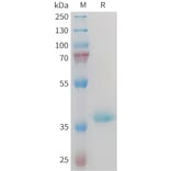 SDS-PAGE - Recombinant Mouse IGF1 Protein (Fc Tag) (A317446) - Antibodies.com